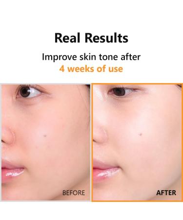 ISNTREE Hyper Vitamin C 23 Serum 20ml - Boost Radiance Even Skin Tone with Vitamin E & Panthenol | Shop Internationally - Buy Online on GoSupps.com