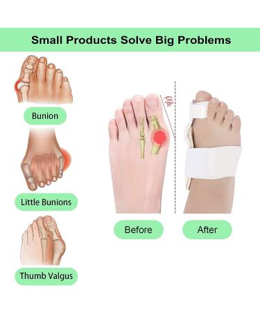 2 Pair Toe Bunion Straightener - Correct Bunions & Restore Toes, Day/Night Toe Separator - Buy Online on GoSupps.com