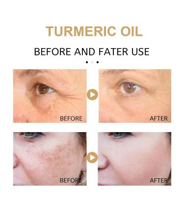3PCS Turmeric Dark Spot Corrector Serum Oil Repair Face Serum Natural Turmeric Skin Dark Spot Skin Care Moisturizing Repair for Face & Body(30ml) - Buy Online on GoSupps.com