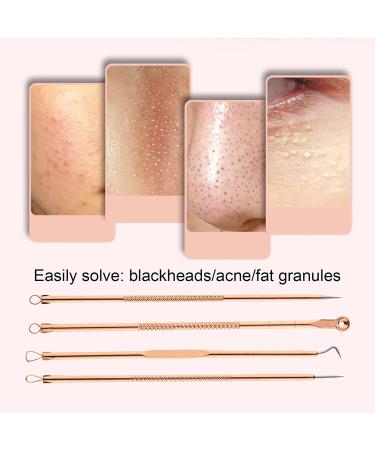 shlutesoy Pimple Pin Multifunctional Wide Applicability Stainless Steel Multifunctional Pimple Blackhead Needle for Girls - Buy Online on GoSupps.com
