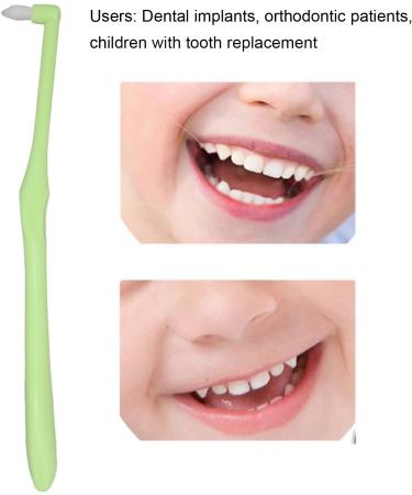 Buy Green Dental Toothbrush for Braces & Implants Stubborn Stains Removal | International Shipping - Buy Online on GoSupps.com
