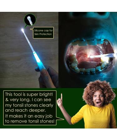 Airgoesin Professional Tonsil Stone Remover Tool with LED Light - Stainless Steel Oral Care & Irrigation Syringe - Blue Tongue Cleaner Scraper - Buy Online on GoSupps.com