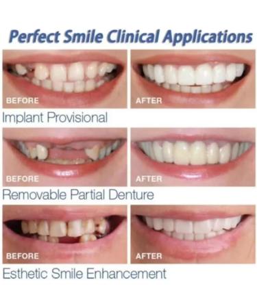 Iksvmsi Prostheses: High-Quality False Teeth & Temporary Dentures for Men - 1 Pair of Veneers for Bad Teeth - Buy Online on GoSupps.com