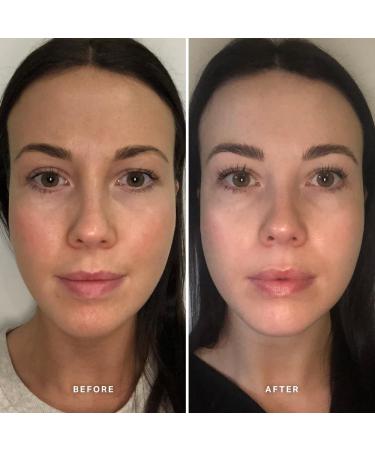 ALPHA-H Vitamin B Serum - 5% Niacinamide for Youthful Skin | Shop Internationally - Buy Online on GoSupps.com