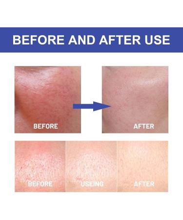 Sunscreen with Hyaluronic Acid SPF 50 Aqueous Solar Hyaluronic Acid Gel for Face Moisturizing Sunscreen Long Lasting Moisturizing Sweatproof for All Skin Types - Buy Online on GoSupps.com