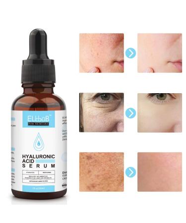 ELBBUB Anti Aging Vitamin C Serum and Hyaluronic Acid Set - Boost Collagen, Hydrate, and Plump Skin - Wrinkle-Fighting Facial Serum - Buy Online on GoSupps.com