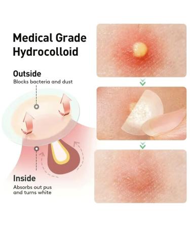 Shop Effective Pimple Patches for Clear Skin - Fast International Shipping - Buy Online on GoSupps.com