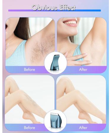 Ladies Bikini Trimmer - LNKERCO 2 in 1 Electric Razor IPX7 Waterproof for Legs, Arms, and Bikini Area - Blue - Buy Online on GoSupps.com