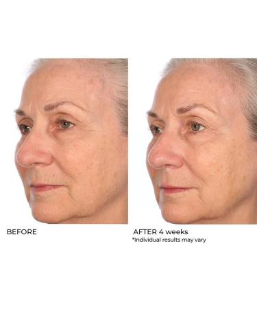 NassifMD Pro Peptide Collagen Serum | Anti-Aging Treatment for Fine Lines Wrinkles & Textured Skin - Firm & Smooth Your Skin - Buy Online on GoSupps.com