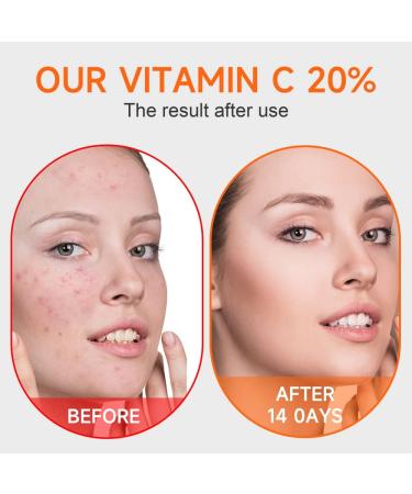 Vitamin C Face Serum with Hyaluronic Acid & Vitamin E - Anti-Aging Radiance Serum for Dark Spots & Even Skin Tone - 1.35 fl oz - Buy Online on GoSupps.com