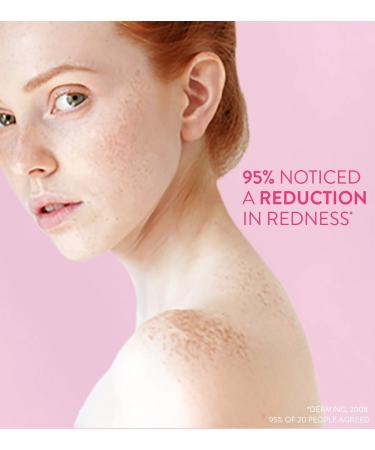 Dermalex 30g Repair Rosacea Cream - Soothes and Calms Sensitive Skin - Buy Online on GoSupps.com