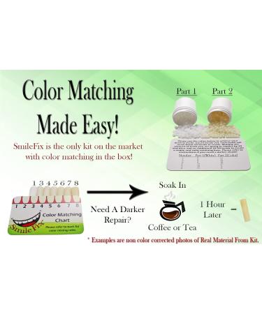 SmileFix Color Matching Deluxe Dental Repair Kit - Fill Gaps and Replace Broken Teeth at Home - Buy Online on GoSupps.com