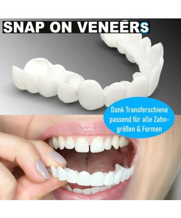 Snap-On Veneers | Comfortable Cosmetic Dental Prosthesis & Flex Dentures for a Perfect Smile - Buy Online on GoSupps.com