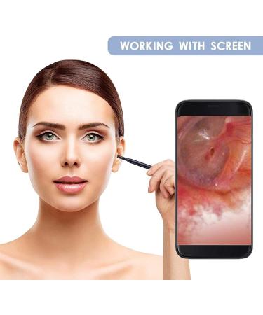 JYYBN Ear Wax Removal Kit with Camera - Ear Cleaner Tool for Adults, Children & Pets - Buy Online on GoSupps.com