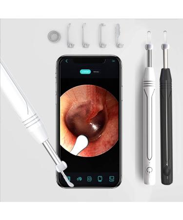 Ear Wax Removal Ear Wax Removal kit Ear Wax Removal Tool Camera 1080P Hd Endoscope  Wireless Ear Cleaner Tools with 6 Led Lights Waterproof Ear Scope Compatible with iPhone & Android Phones  (White)