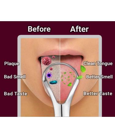 Stainless Steel Tongue Scraper 2-Pack | Travel Cases Included | Fresh Breath & Oral Health for Adults & Kids - Buy Online on GoSupps.com