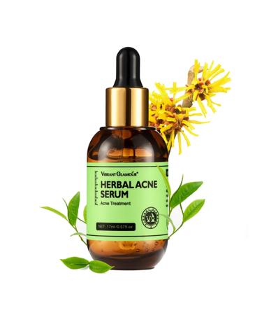 Rosarden Anti Acne Serum for Face Natural Herbal Face Serum for Improvement Pimples Pore Acne Scar Anti Pimple Serum Face Care for All Skin Types of Acne