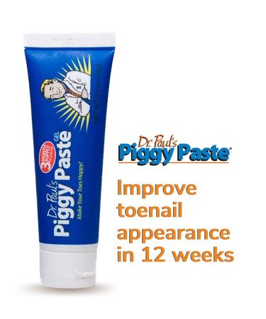 Piggy Paste Toe Nail Fungus Treatment by Dr. Paul - Restores Brittle Yellow Nails To Health - Buy Online on GoSupps.com