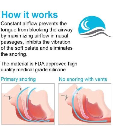 Nose Vents by Snore Bastion - 12 Soft Silicone Nasal Cones for Snoring Relief and Improved Breathing - Buy Online on GoSupps.com