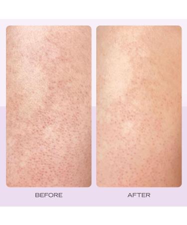 First Aid Beauty KP Bump Eraser Body Scrub - 10% AHA Exfoliating Skin Cleanser for Keratosis Pilaris Strawberry Scent 2 oz - International Shipping Available - Buy Online on GoSupps.com