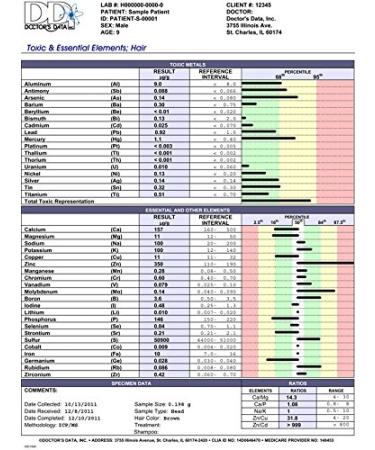 Hair Mineral Analysis