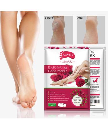 2 Pairs Callus Removal Mask - Moisturizing Foot Patch for Peeling & Soft Feet - International Shipping Available - Buy Online on GoSupps.com