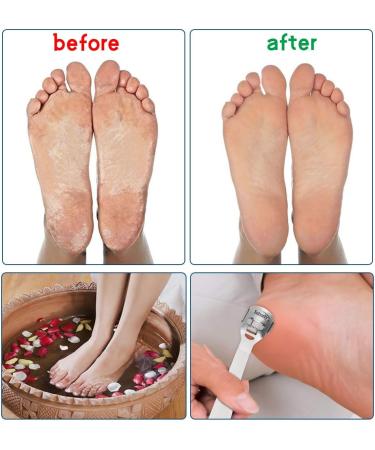 Cornea Removal Pedicure Set | Stainless Steel Foot Corn Remover with 10 Replacement Blades for Smooth Feet - Buy Online on GoSupps.com