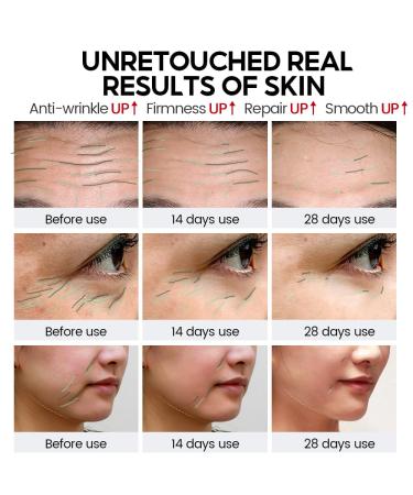3% Retinol Pro+ Complex Serum - Anti-Aging Face Treatment with Peptides Ceramides & Hyaluronic Acid | Reduce Wrinkles & Fine Lines | 1.02 fl. oz - Buy Online on GoSupps.com
