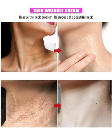 GXFCAI Facelift Cream Slimming Face Lifting Firming Massage Wrinkle Skin Facial Cream Bea Care Cream Moisturizing Aging U4D6 - Buy Online on GoSupps.com