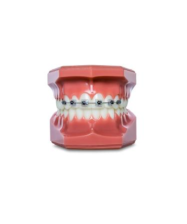 Snapcaps Paw Print 10 Ct: Bracket Cover Bumper for Braces - Orthodontic Accessories - Buy Online on GoSupps.com