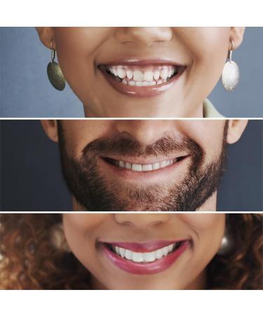 BodyAccel Teeth Whitening Toothpaste - Fluoride-Free Deep Clean for Cavity Repair & Fresh Breath | Removes Tea Coffee & Wine Stains - Cherry Flavor 3.5 oz - Buy Online on GoSupps.com
