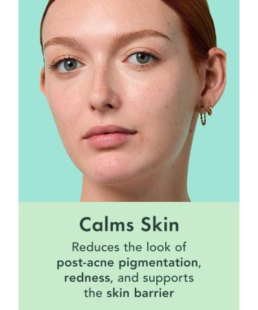 Rael Miracle Clear Acne Treatment Serum - 1.5% Salicylic Acid 2% Niacinamide Pore Minimizer Even Skin Tone | Korean Skincare (1oz 30ml) - International Shipping - Buy Online on GoSupps.com