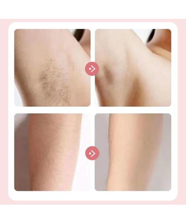 Bikinis Trimmer Pour Femmes Cheveux Pubiens Body Groomer lectriques Shavers Pubic Arms Match pilation De Cheveux Electric Femmes - Buy Online on GoSupps.com