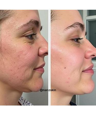  G n rique NANZSKIN Ceramide Barrier Support Balancing Cream - House of Nanz - Buy Online on GoSupps.com