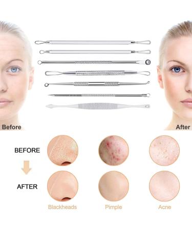Pimple Blackhead Remover Kit - 7 in 1 Extractor Tool Set - Buy Online on GoSupps.com