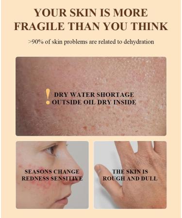 Tallow and Honey Balm - All-Natural Skin Care with Grass-Fed Beef Tallow & Raw Wild Honey - 2 oz Moisturizing Body Oil - Buy Online on GoSupps.com