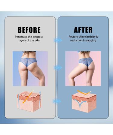 Nadiaen Skin Firming Youth Butter Skin Firming Cream Skin Firming Body Cream Skin Tightening Suitable for Sagging Skin Used for Anti-Aging Firming Improving Wrinkles and Reducing Skin Dryness (80ml 2) - Buy Online on GoSupps.com