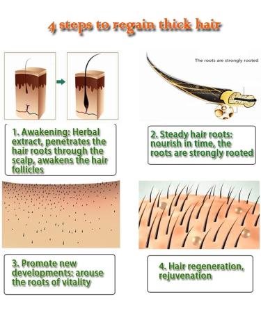  Kingknow Hair Growth Essential Oil Natural Ginger for Hair Loss Treatment Hair Growth Care Ginger Essential Oil Nourishing for Dry Damaged Hair Growth Care 30ml - Buy Online on GoSupps.com