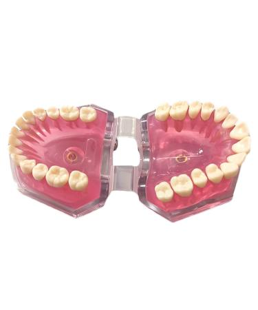 Tooth Lessons Model - Dental Simulation & Standard Practice Demonstration | Resin Dentist Teaching Tool (Pink Rose) - International Shipping Available - Buy Online on GoSupps.com
