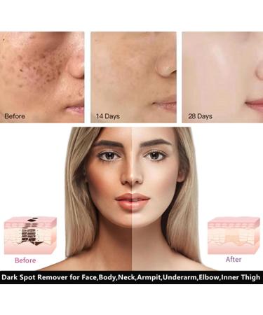 Go Ho 2PCS Dark Spot Remover - Vitamin C Cream for Face Body & More | Effective Blench Lotion & Dark Spots Corrector - Buy Online on GoSupps.com