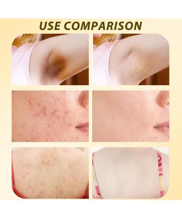 Lioatyo 2 Pcs Bee Venom Comprehensive Cream Professional Bee Venom Cream Natural Bee Venom Cream Bee Venom Skin Care Cream for All Skin Types - Buy Online on GoSupps.com