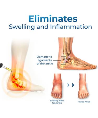German Ankle Tendonitis Therapy Oil - Natural Muscle Massage Oil for Joint Relief (2PC) - Buy Online on GoSupps.com