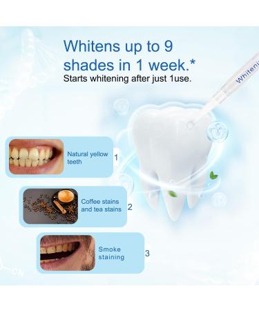 Teeth Whitening Light - 32 LED Red & Blue Intelligent System for Home Stain Removal - USB Accelerator (Black - Buy Online on GoSupps.com