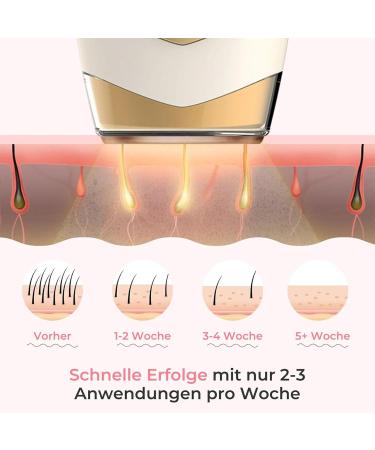 Womens shavers epilators Facial Epilator Hair Removal Device Facial Epilator Cordless Epilator Shaving Kit Rechargeable Body Hair Trimmer Beige C - Buy Online on GoSupps.com