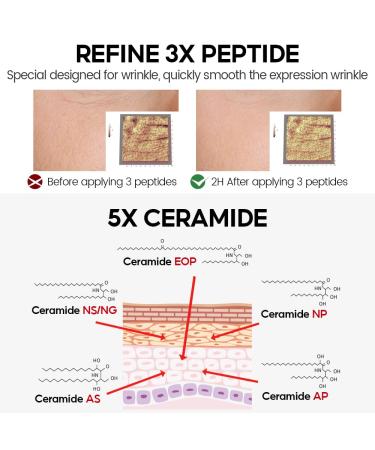 3% Retinol Pro+ Complex Serum - Anti-Aging Face Treatment with Peptides Ceramides & Hyaluronic Acid | Reduce Wrinkles & Fine Lines | 1.02 fl. oz - Buy Online on GoSupps.com