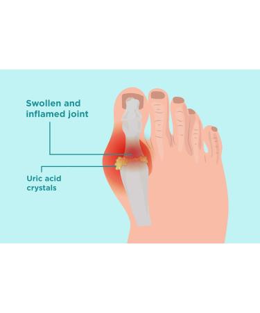 MediMad Uric Acid Gout Urine Test Strips GP/Pro Use CE Marked - Buy Online on GoSupps.com