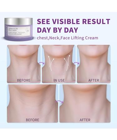  Andemie Seumfy Go Pure Beauty Tighten & Lift Neck Firming Cream - 1.7 Fl Oz. - Buy Online on GoSupps.com