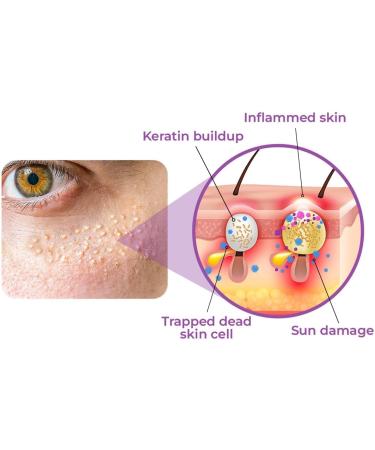 Milk Spots Electric Serum Pen 2023 Anti-Aging Moisturizing Cream for Fine Lines & Skin Care | International Shipping - Buy Online on GoSupps.com