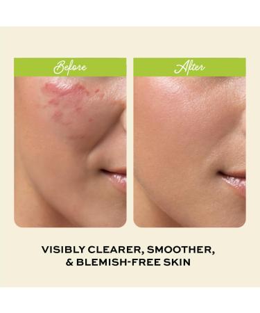 Clarifying Toner for Face - Salicylic Acid Toner - Spot and Oil Control Cruelty-Free Skincare by The Natural and Organic Family - 7.04 oz Apple - Buy Online on GoSupps.com