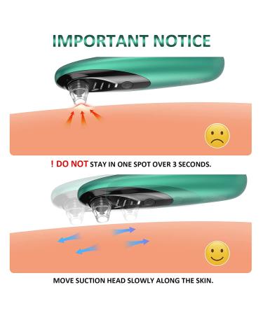 Blackhead Remover Pore Vacuum with Camera - Rechargeable Blackhead Suction Tool for Face and Nose - Skin Acne Pimple Cleaner for Men and Women - Buy Online on GoSupps.com